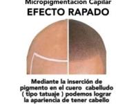 imagen-10