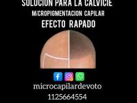 imagen-11