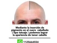 imagen-4