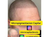 imagen-5