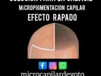 imagen-6
