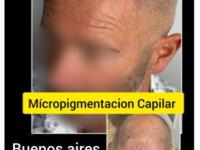 imagen-8