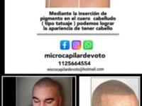 imagen-9